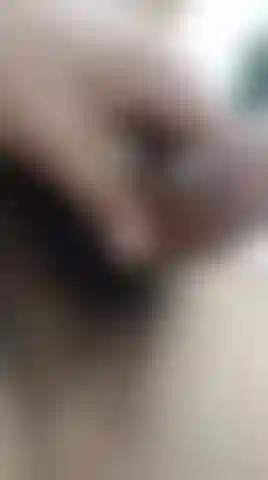 Many hairs on my balls