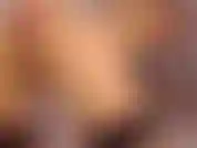 anal 1(fart,prolapse,gape)