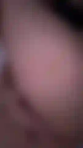 anal view