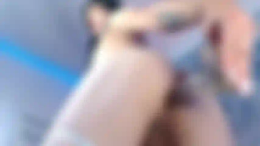 dilated ass